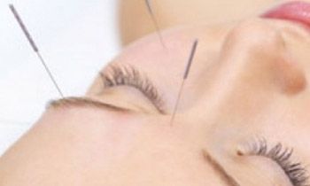 Acupuntura y Homeopatía
