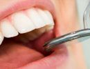 servicios-endodoncia